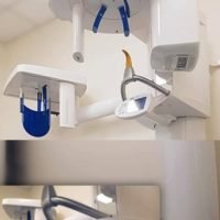 ΥΠΕΡΣΥΓΧΡΟΝΟ ΑΚΤΙΝΟΛΟΓΙΚΟ ΜΗΧΑΝΗΜΑ ΣΤΟ ΝΟΣΟΚΟΜΕΙΟ ΣΑΝΤΟΡΙΝΗΣ