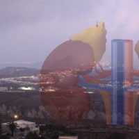 ΚΙΝΔΥΝΕΥΕΙ Η ΖΩΗ 18 ΝΕΦΡΟΠΑΘΩΝ ΣΤΗ ΣΑΝΤΟΡΙΝΗ