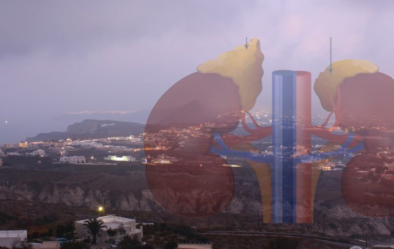 ΚΙΝΔΥΝΕΥΕΙ Η ΖΩΗ 18 ΝΕΦΡΟΠΑΘΩΝ ΣΤΗ ΣΑΝΤΟΡΙΝΗ